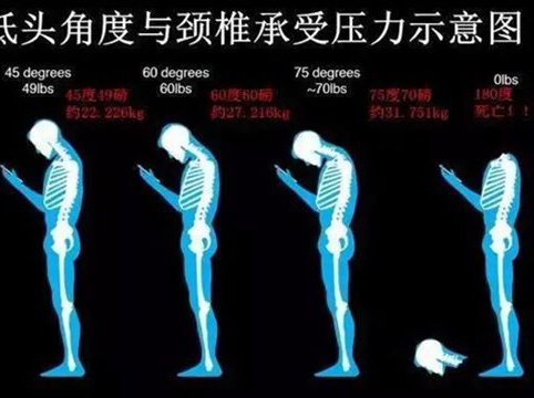 頸椎病、頸椎病、我用這些方法治頸椎